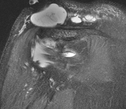 Figure 3 for case Geyser phenomenon
